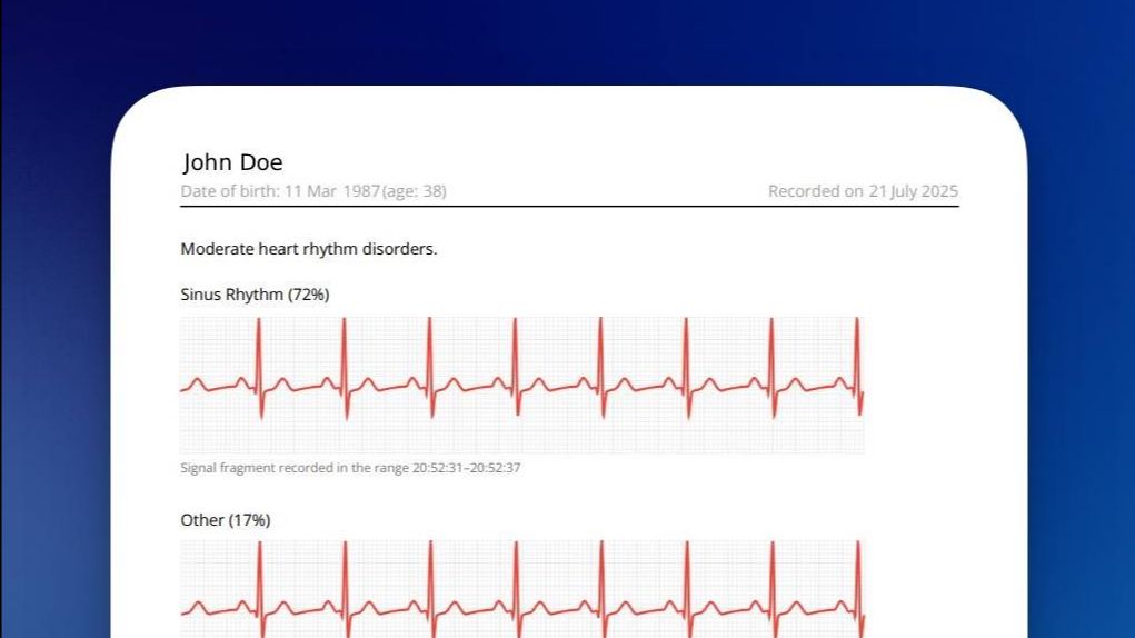 ECG report