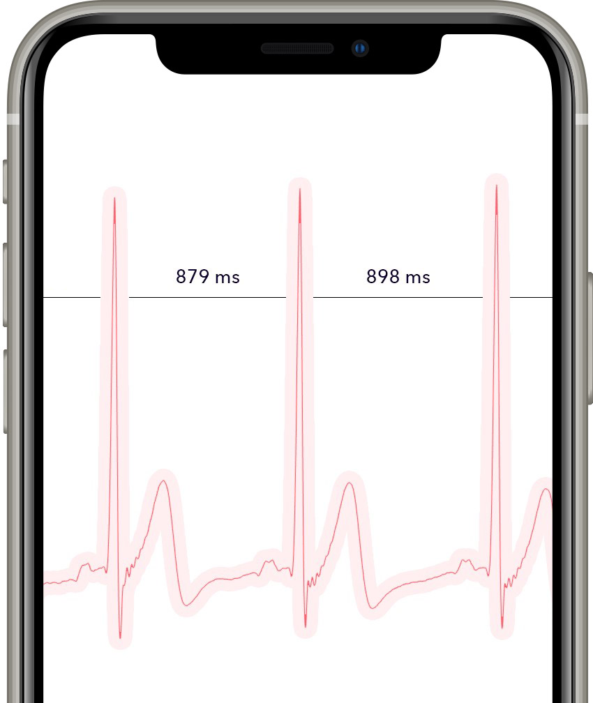HRV