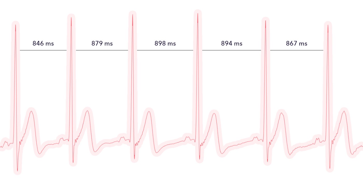 HRV