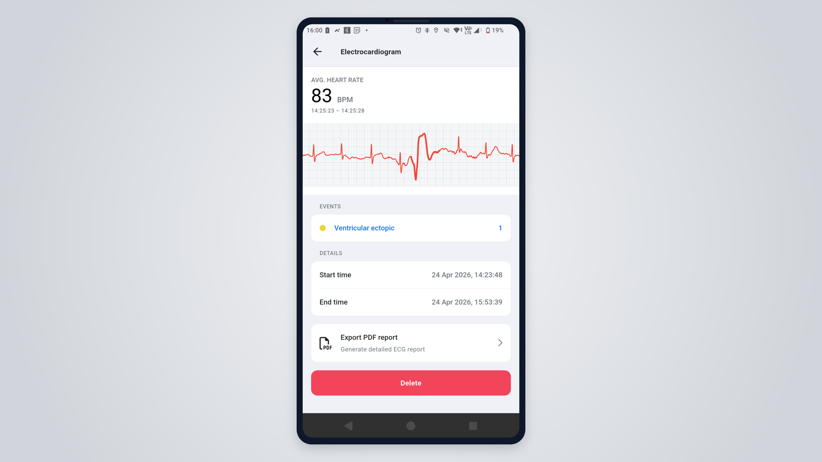 Aidlab mobile ECG analysis preview