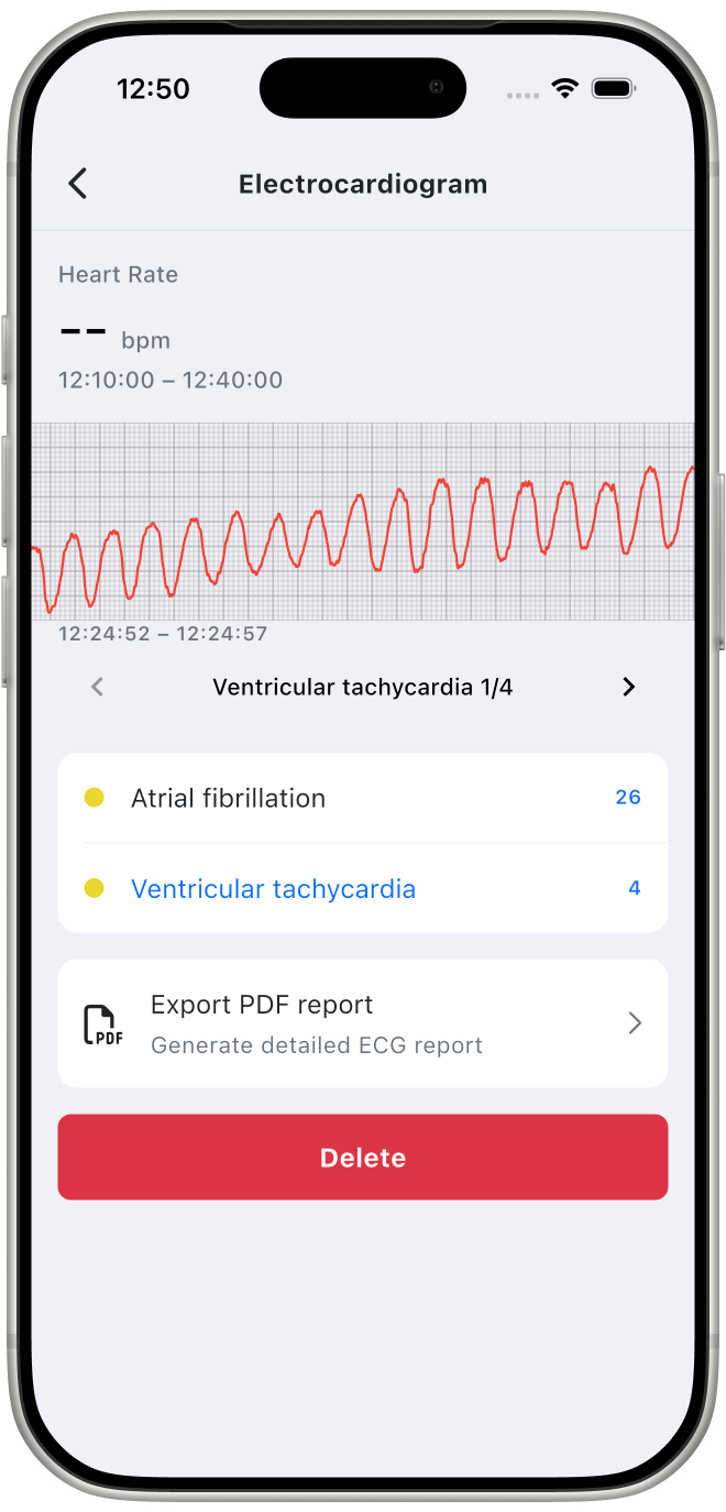 Komponent elektrokardiogramu