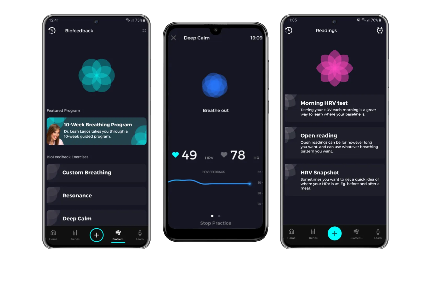 Different views of the Elite HRV app